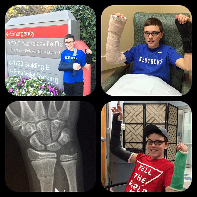 The next 6 weeks are going to be interesting for the boy (& us). Who breaks 2 arms? Seriously!